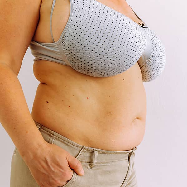 A woman who is a good candidate for Breast Reduction Surgery