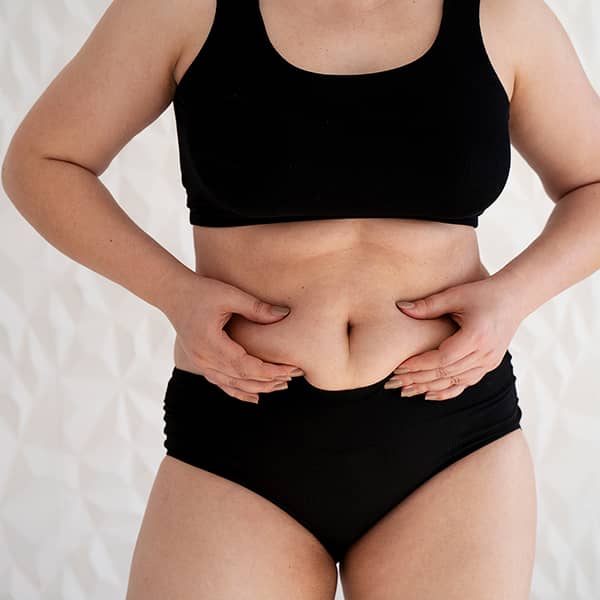 A woman demonstrating why she wants abdominal liposuction