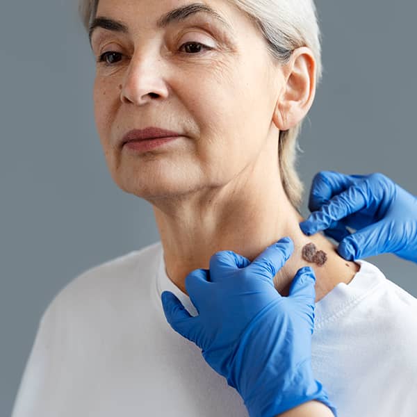 A plastic surgeon evaluating a women's neck for reconstructive surgery